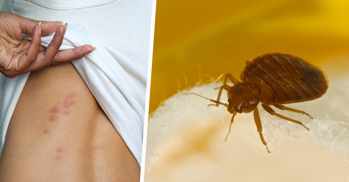 Punaises de lit. Il faut commencer par arrêter de chercher la petite bête